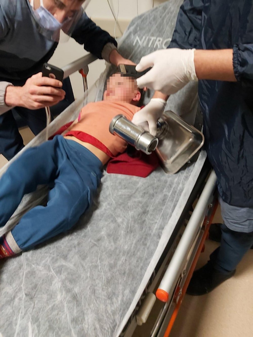 Eskişehir’de elini kıyma makinesine kaptıran 3 yaşındaki yabancı uyruklu çocuk, makine parçalarıyla birlikte getirildiği hastanede başarılı bir operasyon geçirdi.